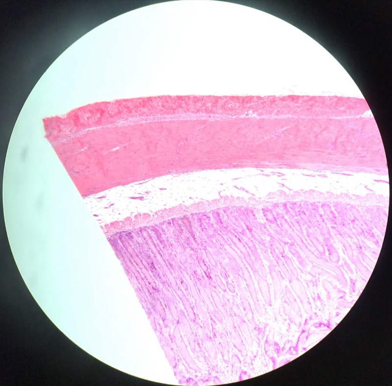 Duodenum - bild 3