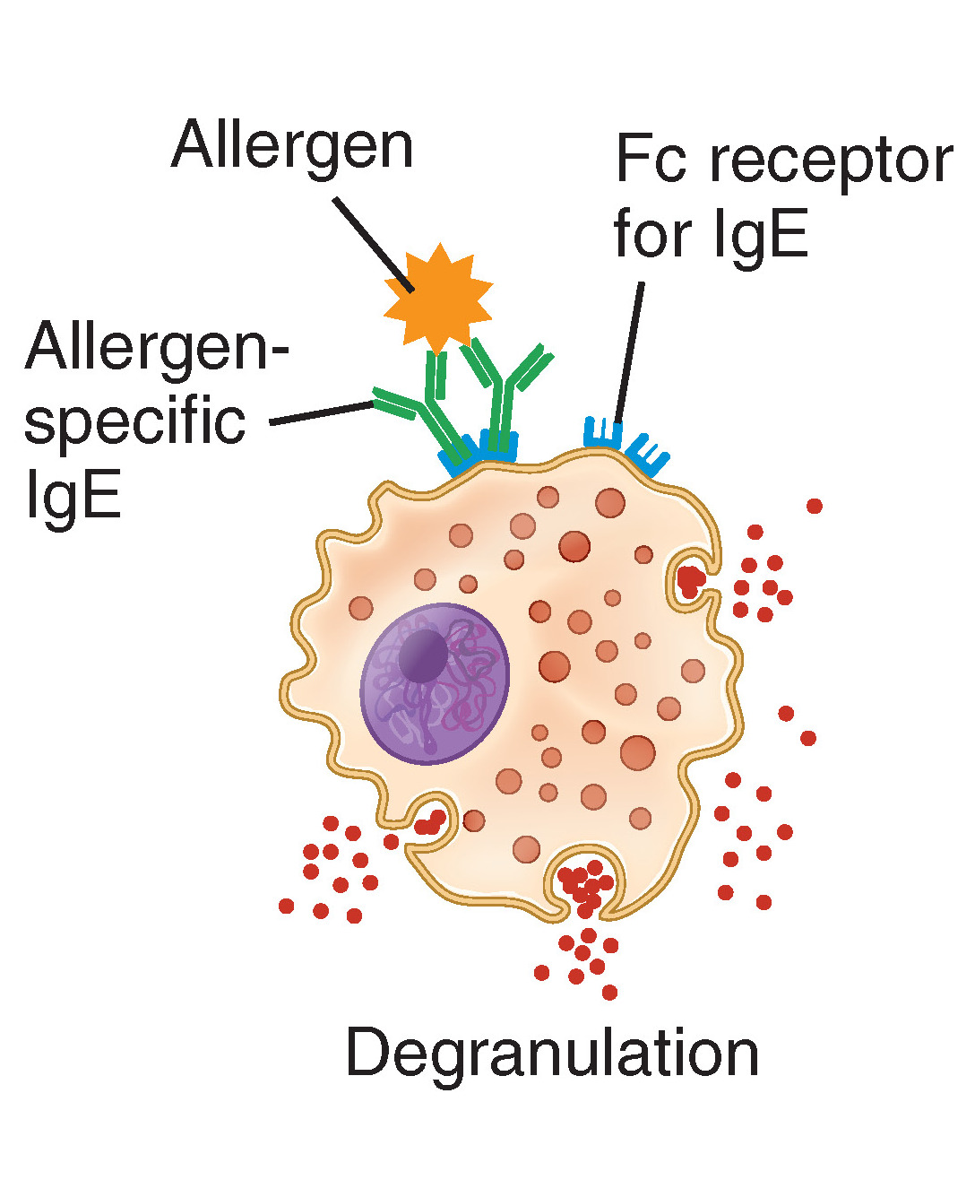 Översiktsdiagram över de fyra typerna av hypersensitivitet: typ I (IgE-medierad), typ II (antikropp mot cell), typ III (immunkomplex) och typ IV (T-cellsmedierad), med respektive immunmekanism.
