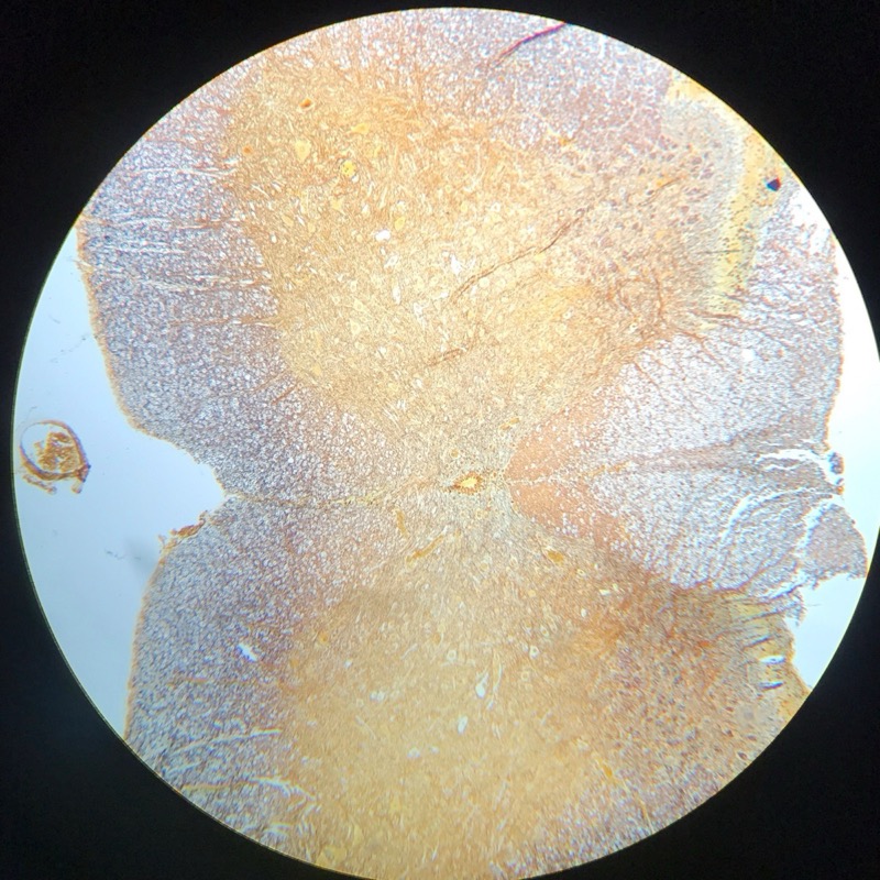 Medulla spinalis, silverfärning - bild 1