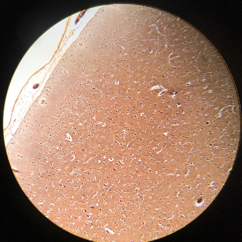 Cerebrum cortex , Silverfärgning - bild 4