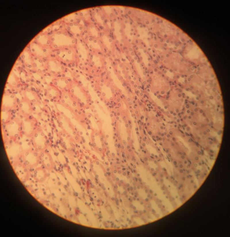 Njure - cortex och medulla - bild 10