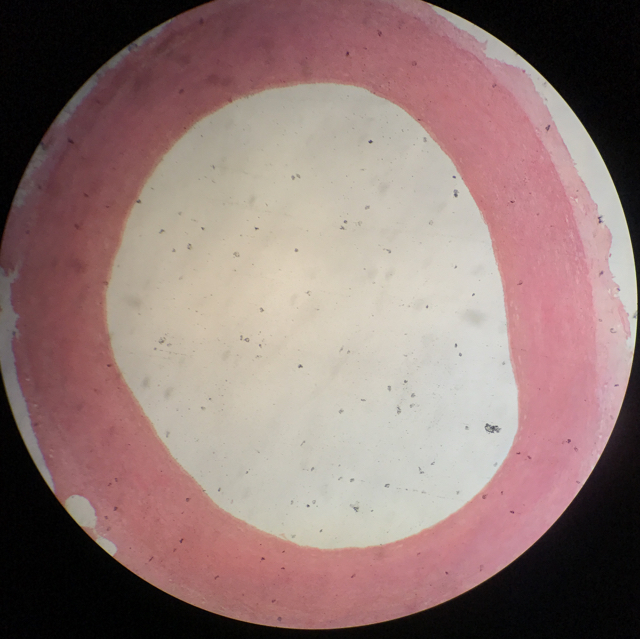 Aorta - bild 1