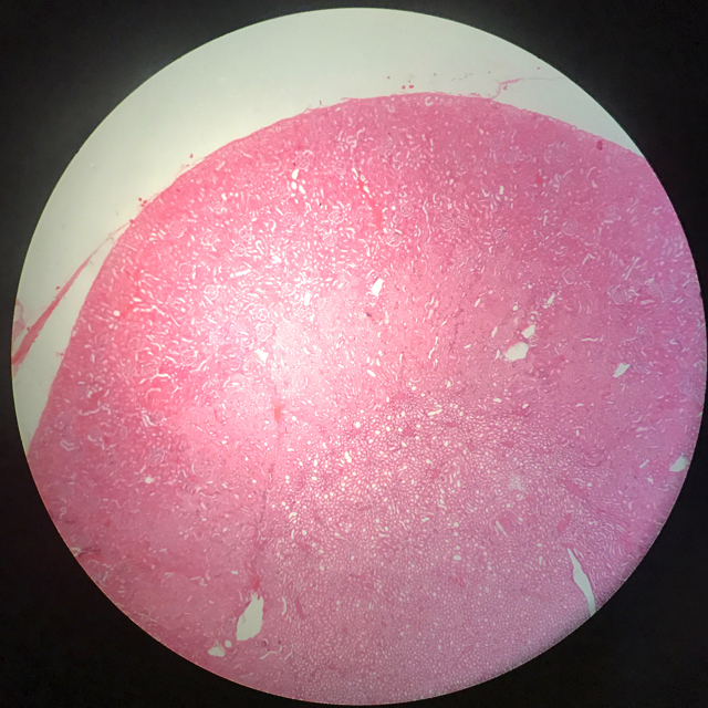 Njure - cortex och medulla - bild 5