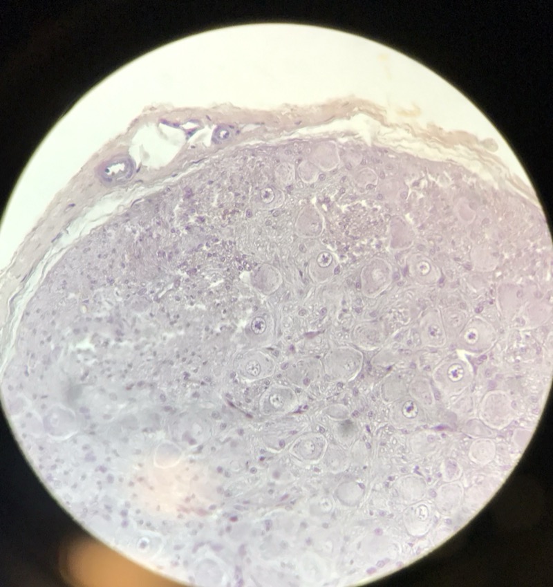 Sympatiskt Ganglion - bild 1