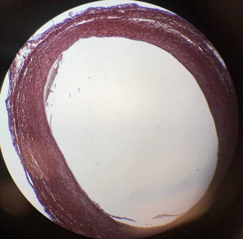 Aorta (extra) - bild 1