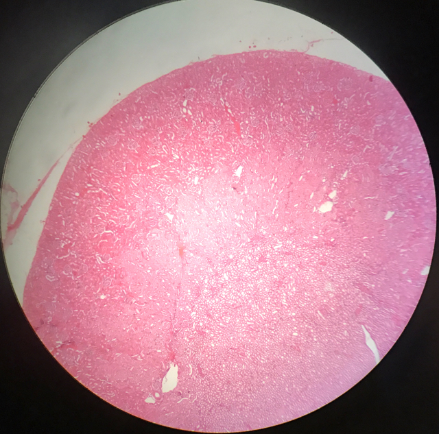 Njure - cortex och medulla - bild 3