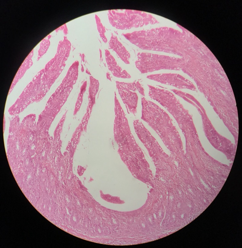 Ileum - bild 2