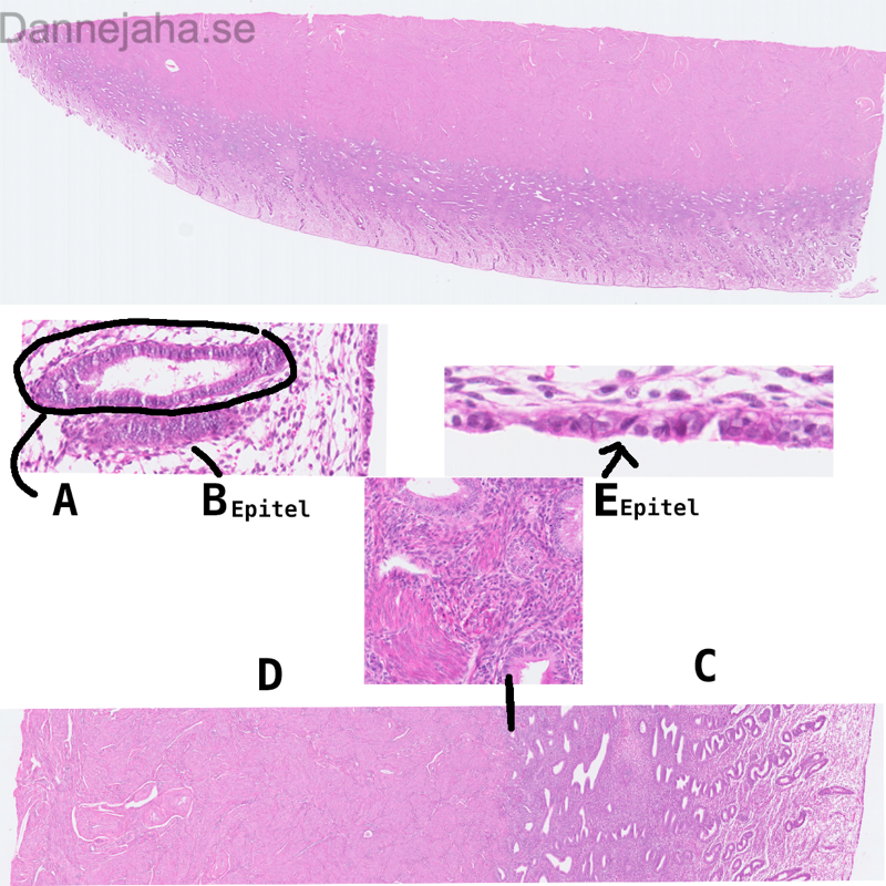 Uterus - bild 1