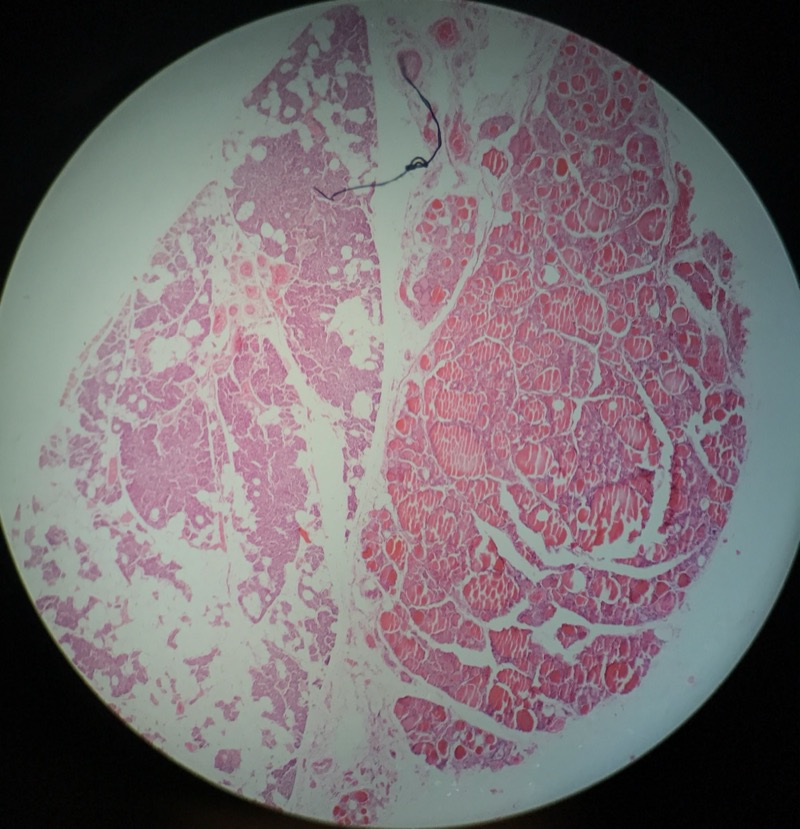 Parathyroidea - bild 1